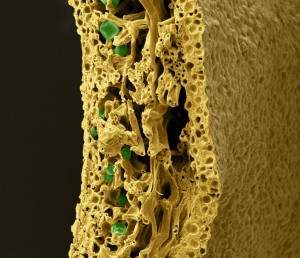 Coupe transversale d’un lichen observé au microscope électronique à balayage. On remarque un dense réseau de filaments de champigon (en jaune-orangé) et les cellules d’algues (en vert). © Yannick Agnan - Tous droits réservés.